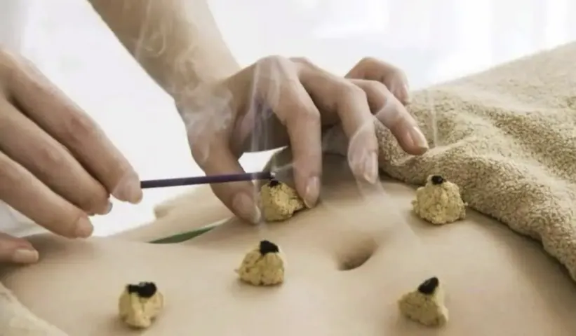 Kangrentang TCM Tuina and Moxibustion Session in Beijing